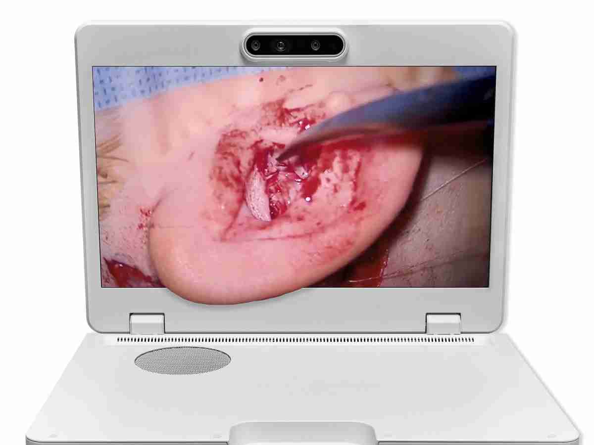 达擎之＂Heads-up 3D显微手术显示系统＂，，整合4K裸眼3D显示及眼球追踪系统，，具备快速追踪人眼移动位置功能，，，，减轻医师长时间维持固定姿势的负担，，让医师能有更宽广清晰的3D立体视野及更舒适的姿势来执行手术。。。。